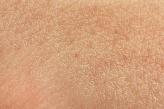 Texture of dry skin as background, macro view
