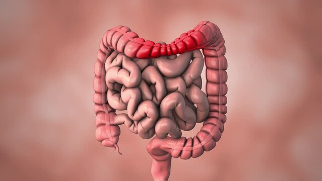 Medical animation of the irritable bowel syndrome