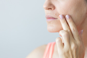 Young woman with nasolabial wrinkles, problem dry skin and with big pores on the face. Woman with...