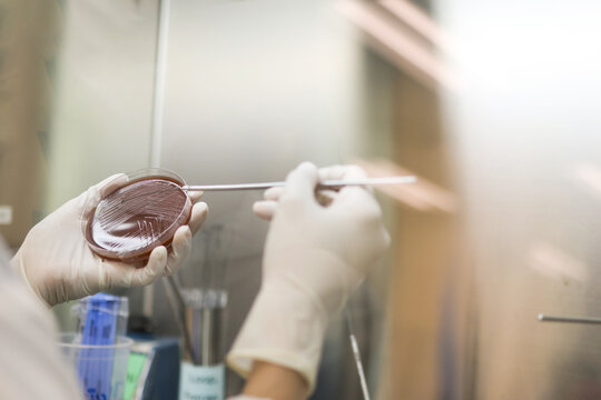 A research laboratory Streak colony on a petri dish in microbiology lab for antibiotic resistance, Drug resistant gonorrhea, Sexual transmitted diseases.