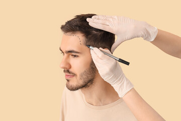 Doctor marking young man's forehead  with hair loss problem on beige background, closeup