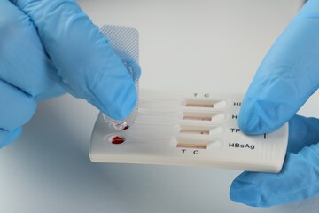 Doctor dropping buffer solution onto disposable multi-infection express test cassette at white...
