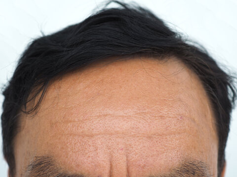 Middle aged man with wrinkles on the forehead. closeup photo, blurred.