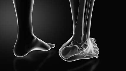 Ankle injury with dislocation and sprains