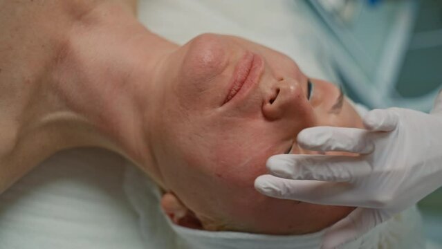 Aesthetic Clinic Procedure: Micro-Needling Lift for Enhancing Skin Health and Beauty in Mature Women. High quality 4k footage