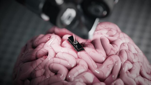 The concept of implanting a chip into the human brain with the help of a robotic arm. Modern technology of the future