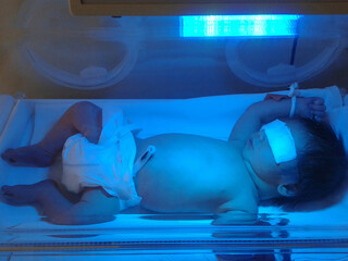 A newborn baby lies in a pressure chamber with ultraviolet light