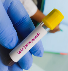 Blood sample for DHEAS (dehydroepiandrosterone sulfate) hormone test. A medical testing concept in...