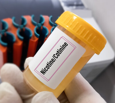 Urine test sample for Cotinine or Nicotine test, an alkaloid found in tobacco and also the predominant metabolite of nicotine, it is used as a biomarker for exposure to tobacco smoke.