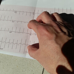 Mano di un dottore sull'esito dell'elettrocardiogramma