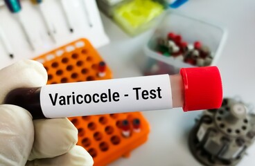 Varicocele, is the enlargement of the veins that transport oxygen-depleted blood away from the...