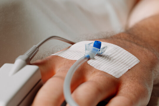 Close-Up View of Patient Arm with IV Catheter During Medical Care