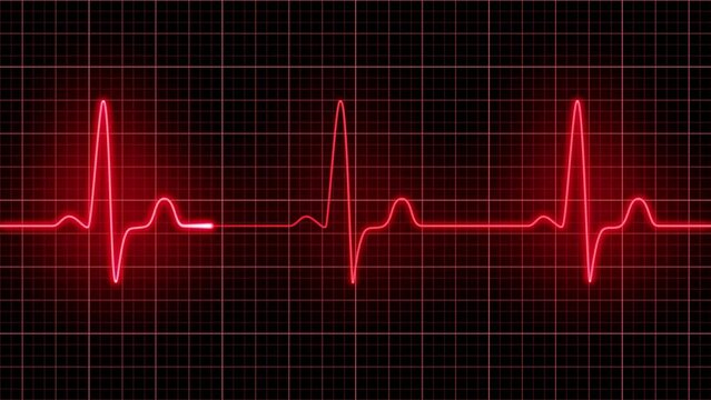 心電図のループ映像