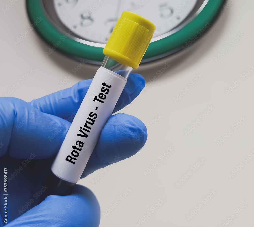 Sticker Blood sample for Rotavirus test. Scientist holding Rotavirus infected blood in test tube laboratory background.