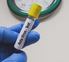 Blood sample for Rotavirus test. Scientist holding Rotavirus infected blood in test tube laboratory...