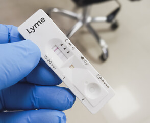 Rapid test cassette for Lyme disease testing at laboratory.