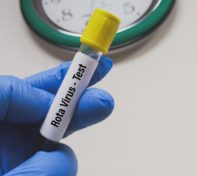 Blood sample for Rotavirus test. Scientist holding Rotavirus infected blood in test tube laboratory background.