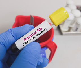 Tetanus Antibody test. vaccine response measurement test.