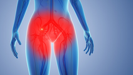 Peripheral nerve clot pain in body