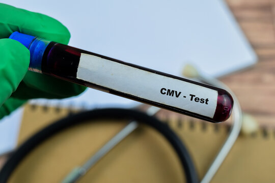 CMV - Test with blood sample on wooden background. Healthcare or medical concept