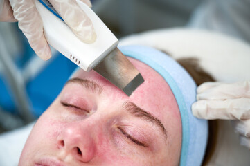 Close up of ultrasound skin cleaning and facial peeling procedure in beauty clinic. Macro shot of...