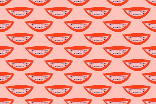 Smiling mouth with orthodontics. Dentist concept