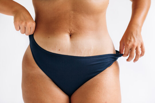 Woman in Her Underwear in Studio