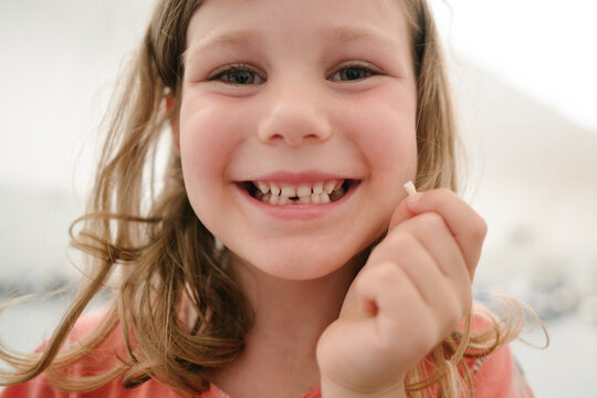 Little girl lost her first tooth