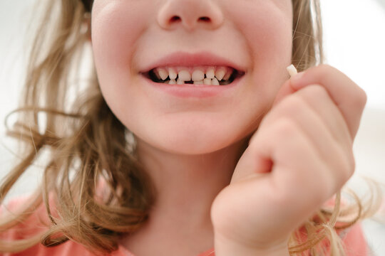 A little girl lost her first tooth