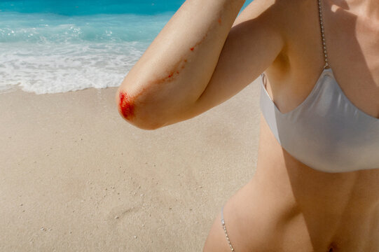 Injured at the beach