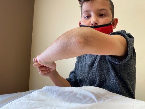 Boy holding up his arm to show his broken elbow. 