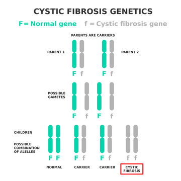 Cystic fibrosis genetics. Cystic fibrosis is an example of a recessive disease. Parents are carriers of affected allele. Children have different possible combination of genes. Vector illustration. 