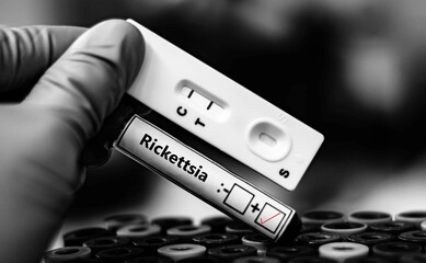 Blood sample of patient positive tested for rickettsia by rapid diagnostic test.