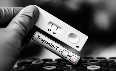 Blood sample of patient positive tested for troponin T by rapid diagnostic test.