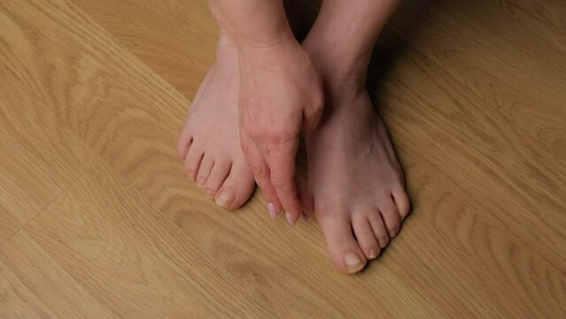 Close-up of a woman's feet with hallux valgus.