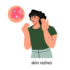 Woman with acne rashes on face skin, flat vector illustration isolated on white. Acne and other dermatological skin problems, inflammation and infections.