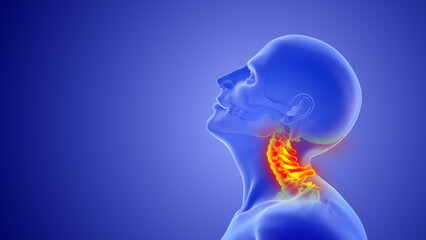 Whiplash mechanism in cervical spine or neck injuries - obrazy, fototapety, plakaty