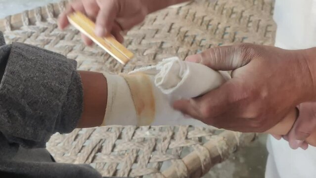 Traditional Pakistani Hakeem Treating Boy's Broken Arm with Herbal Remedy