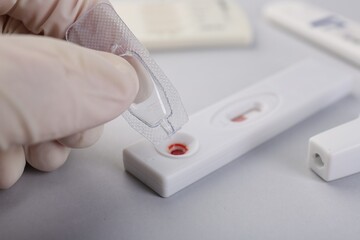 Doctor dropping buffer solution onto disposable express test cassette on light background, closeup