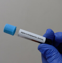 Blood sample for Alpha 2-antiplasmin, activity test for diagnosing inherited thrombotic or bleeding...