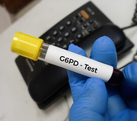 Blood sample for G6PD(glucose-6-phosphate dehydrogenase) test, helps red blood cells (RBCs)...