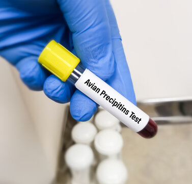 Blood sample for Avian Precipitins test to detected include avian, fungal, thermophilic actinomycetes. Aspergillosis.