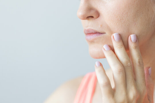 Young woman with nasolabial wrinkles, problem dry skin and with big pores on the face. Woman with the mole above the lip.