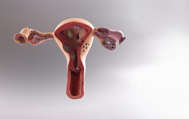 Closeup of artificial plastic model of uterus and ovaries on gray background. Gynecological education concept