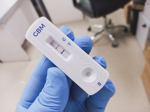 Rapid test device for Glomerular Basement Membrane Antibody or GBM IgG test to diagnosis of asture&rsquo;s Syndrome (Anti-GBM disease). Kidney disease.
