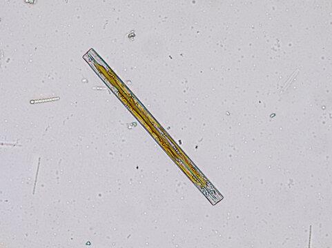 Synedra ulna (unicellular freshwater diatom algae) under the microscope - optical microscope x400 magnification