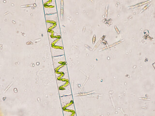Spirogyra algae (filamentous green algae) under the microscope - optical microscope x400...