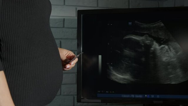 Woman refuse for birth control. A pregnant woman refuse to control the birth with condom.