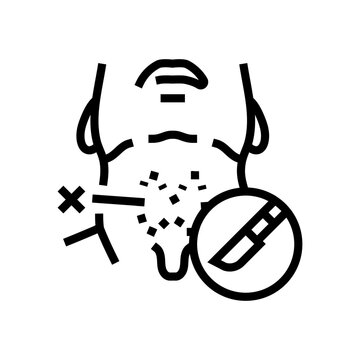 thyroidectomy surgery line icon vector. thyroidectomy surgery sign. isolated contour symbol black illustration