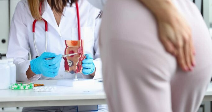 Doctor holds a model of unhealthy lower rectum with inflamed vascular structures. Patient with hemorrhoid problem at medical appointment concept